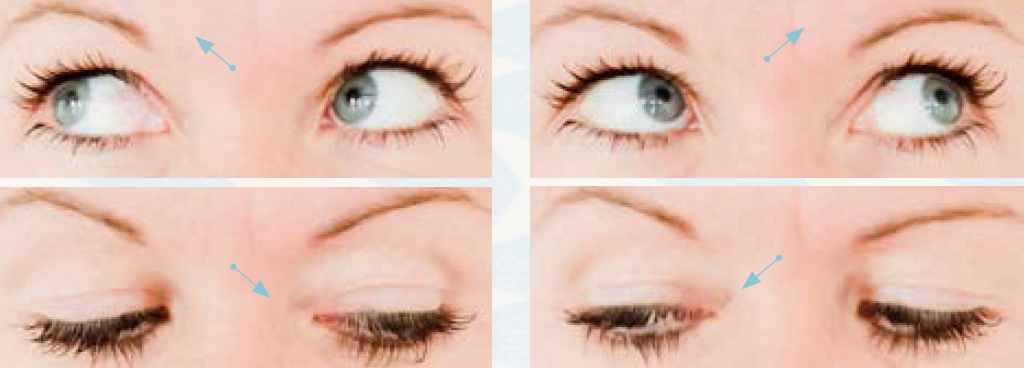 Augen-Yoga - schräg nach oben und unten schauen