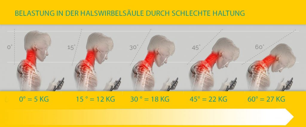 Bürorücken Rundrücken und TechNeck - Verspannung in der Halswirbelsäule